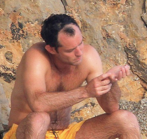 jude law hair loss