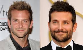 Has Bradley Cooper Had A Hair Transplant Celebrities Hair Transplants