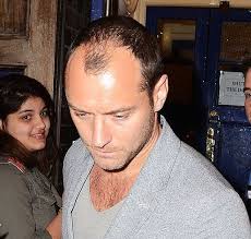 jude law going bald