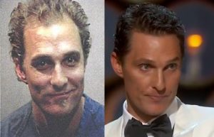 matthew mcconaughey hair transplant