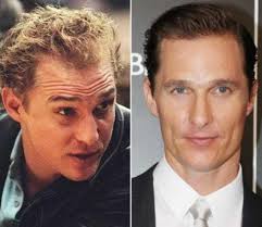 matthew mcconaughey hair treatment