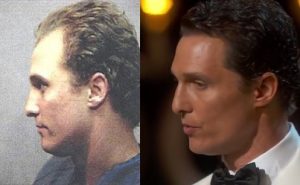 matthew mcconaughey hair implant