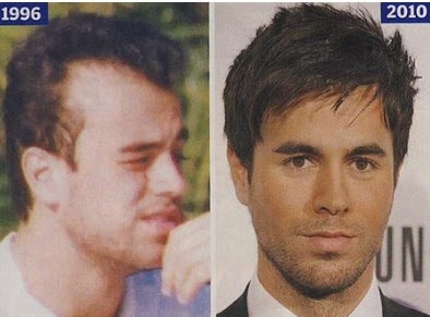 enrique iglesias transplant