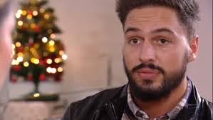 Mario Falcone had a beard transplant