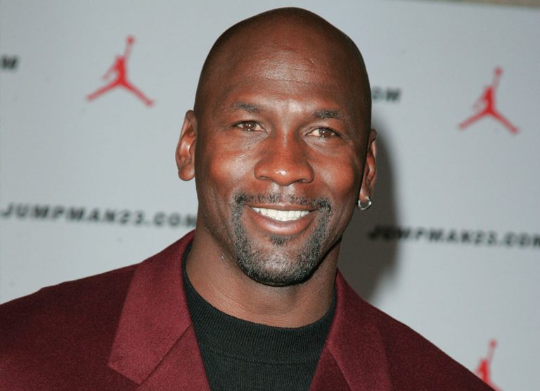 Michael Jordan 3 Celebrities hair transplants