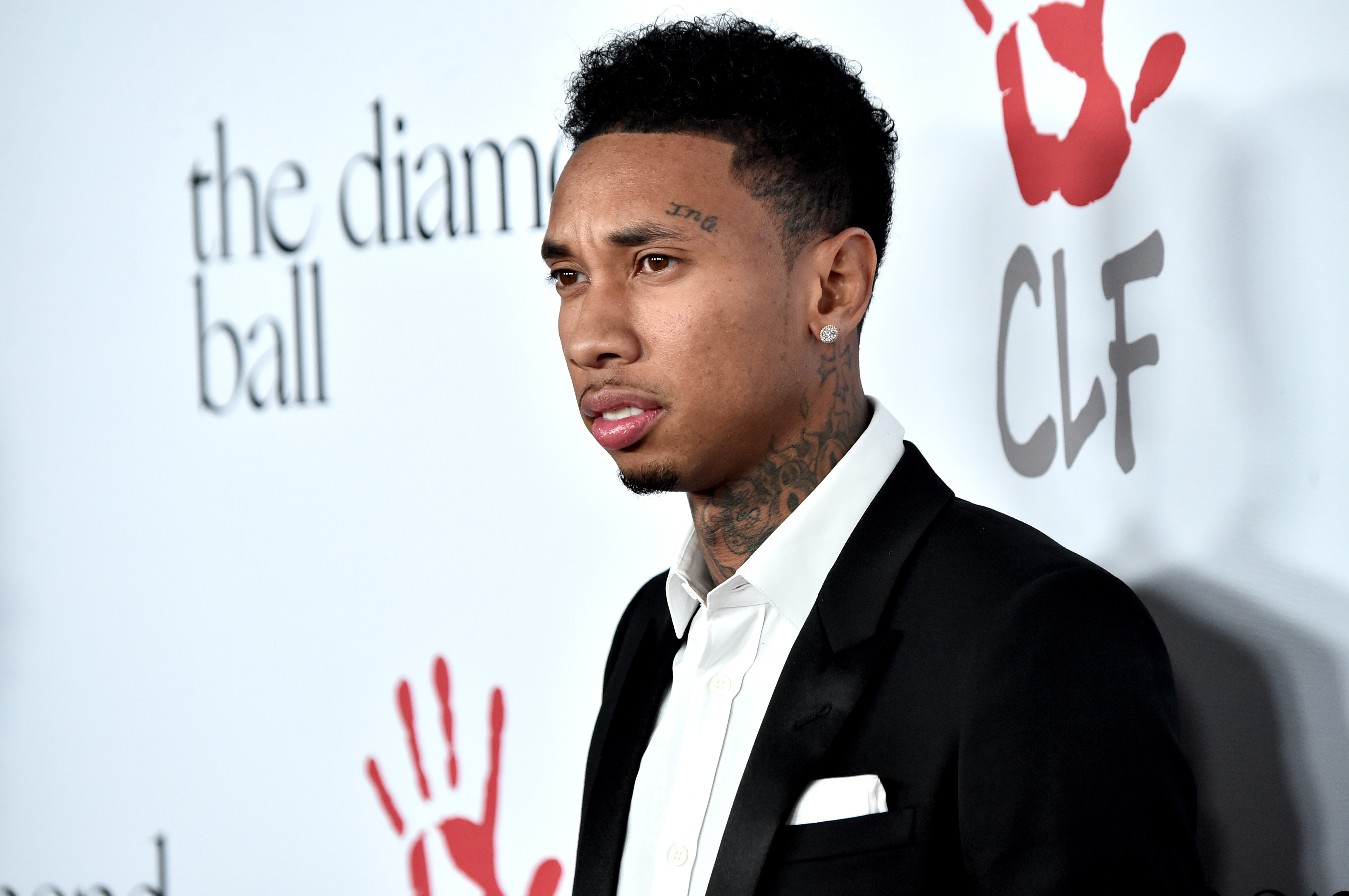 Tyga Hairline Makeover: What’s the Truth? 