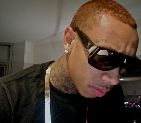 Tygas Hairline Before Hair Transplant.