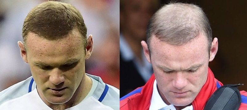 rooney new hair before and after