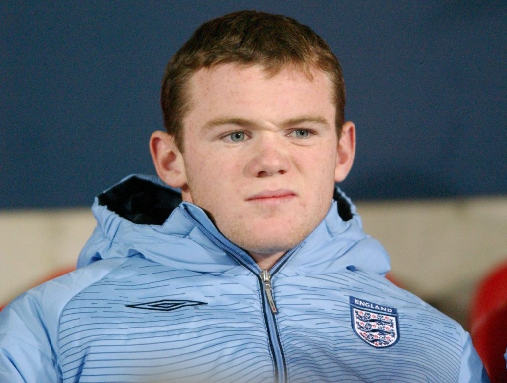 wayne rooney hair transplant