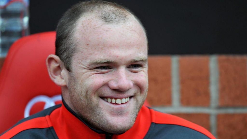 rooney hairline