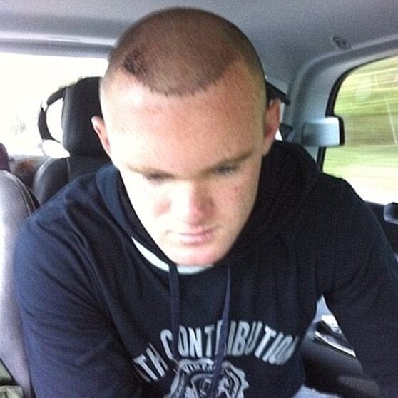 rooney bald