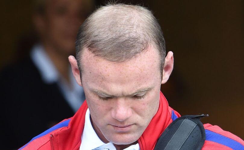 wayne rooney before and after hair